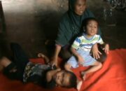 Miris, Kakak Beradik Idap Hydrocephalus