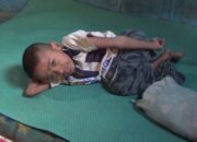 14 Tahun Adik Lumpuh, Kakak Depresi