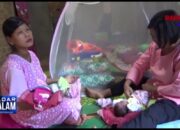 USG KEMBAR DUA, LAHIR TERNYATA TIGA