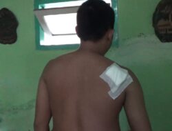 Teror Geng Motor, Pisau Tertancap di Bahu