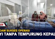 RSUDAM Sukses Operasi Bayi Tanpa Tempurung Kepala